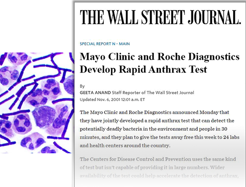 Anthrax Test